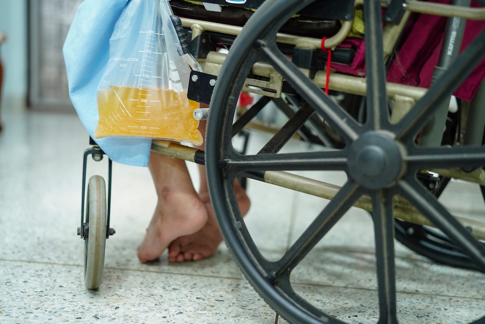 Les facteurs clés de succès pour une entreprise de poches urinaires
